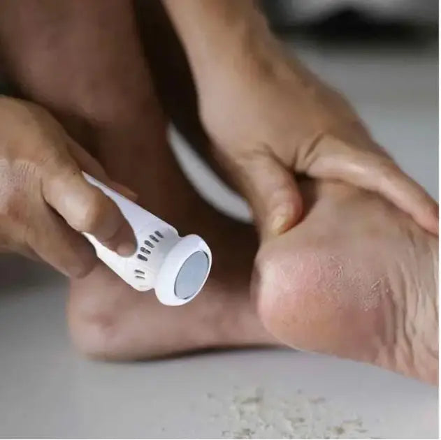 Пемза электрическая FOOT GRINDER 928-3 для ног и пяток с насадками