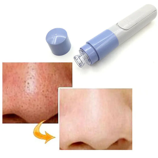 Вакуумный очиститель пор Pore Cleaner