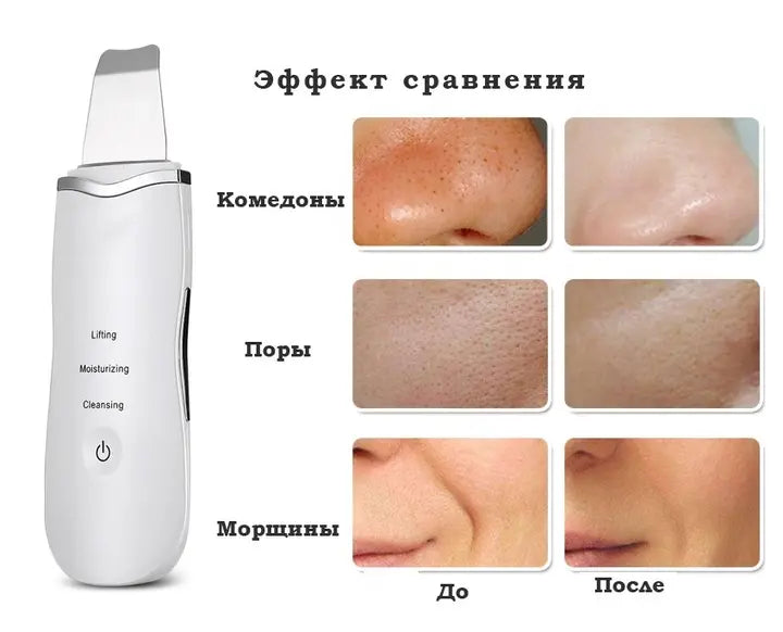 Аппарат для ультразвуковой чистки лица Ultrasonic Shovel